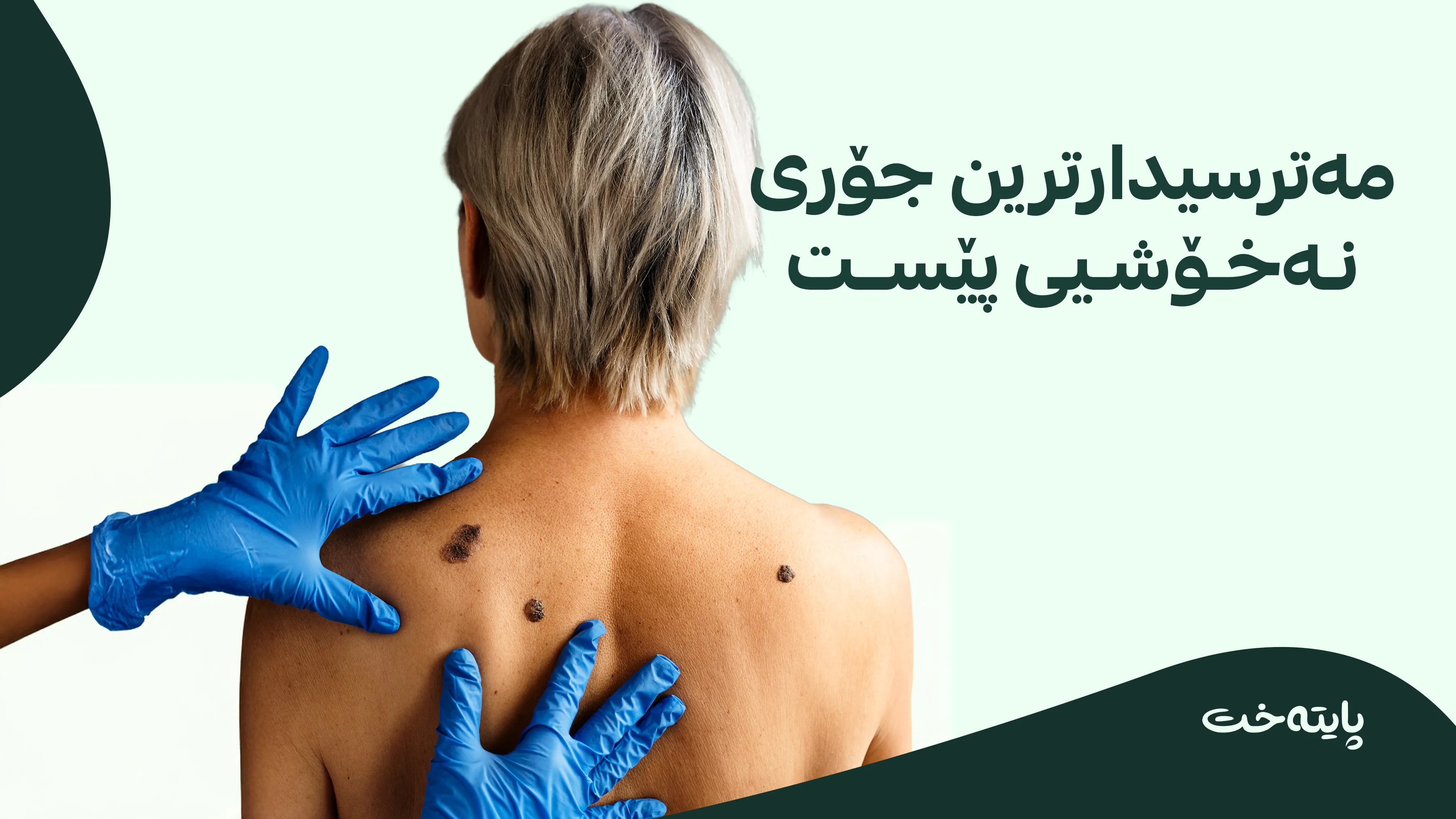  پیاوان زیاتر ڕووبەڕووی مەترسیی پێست دەبنەوە