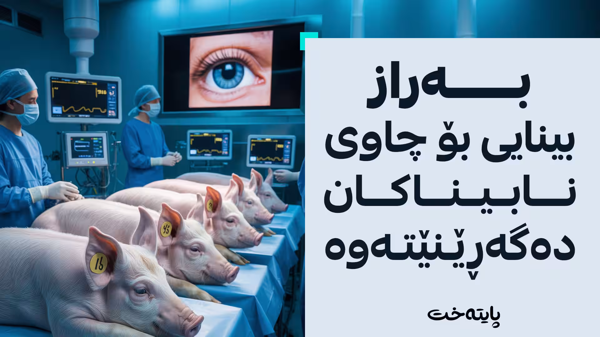 بەراز ڕووناکی بۆ چاوی نابیناکان دەگەڕێنێتەوە 