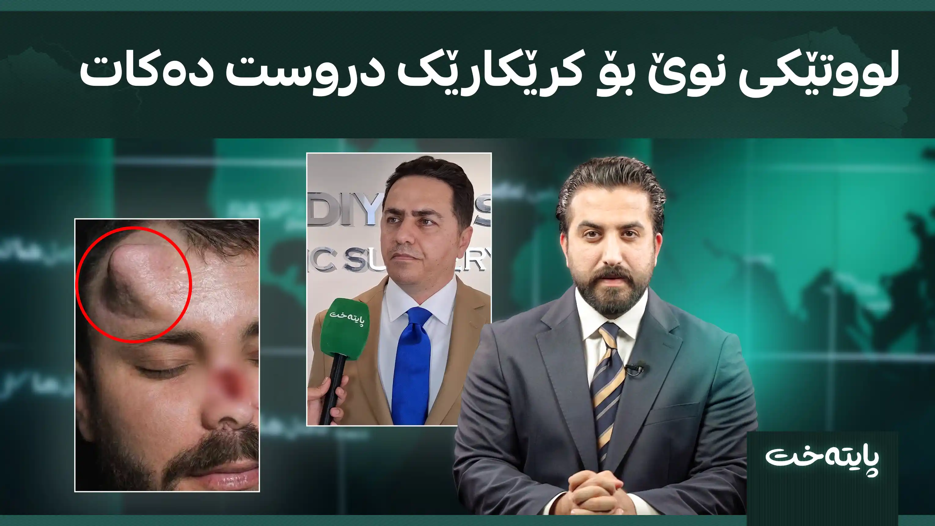 لووتێکی نوێ بۆ کرێکارێک دروست دەکات