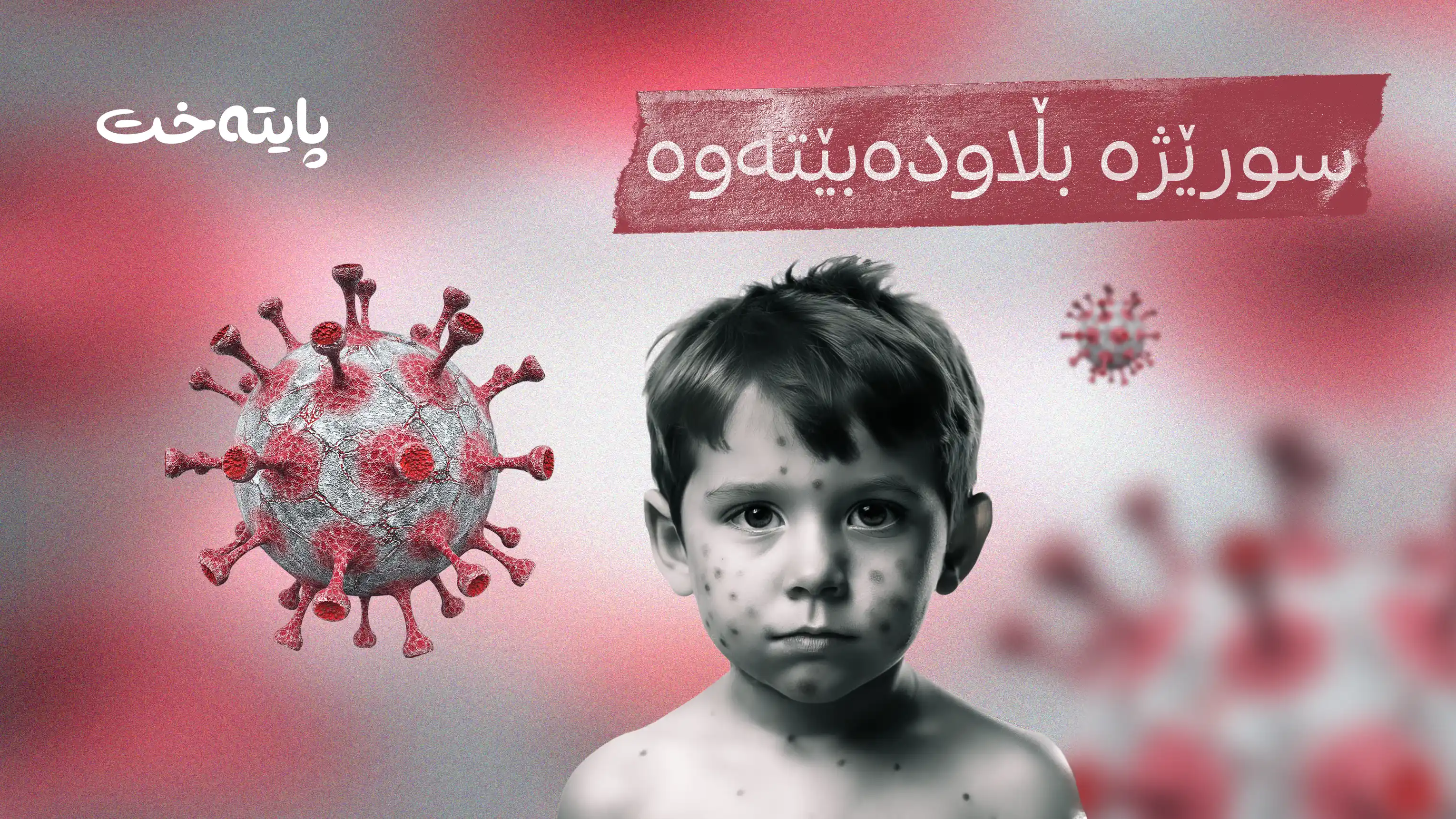 تەندروستی هەولێر هۆشداری لەبارەی پەتای سوورێژەوە دەدات